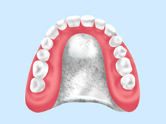 自費入れ歯