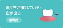 歯ぐきが腫れている・血が出る 歯周病