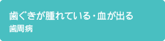 歯ぐきが腫れている・血が出る 歯周病